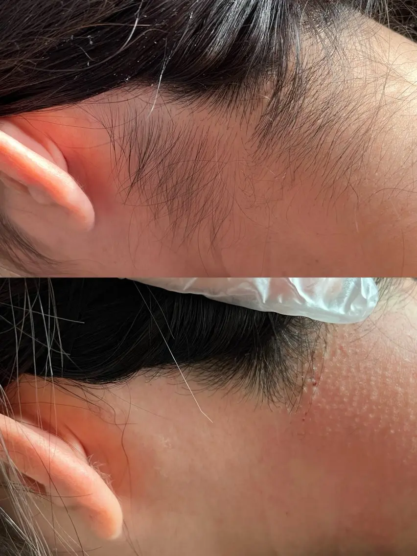 脱毛 salon Lua🌛のエステ・リラクイメージ