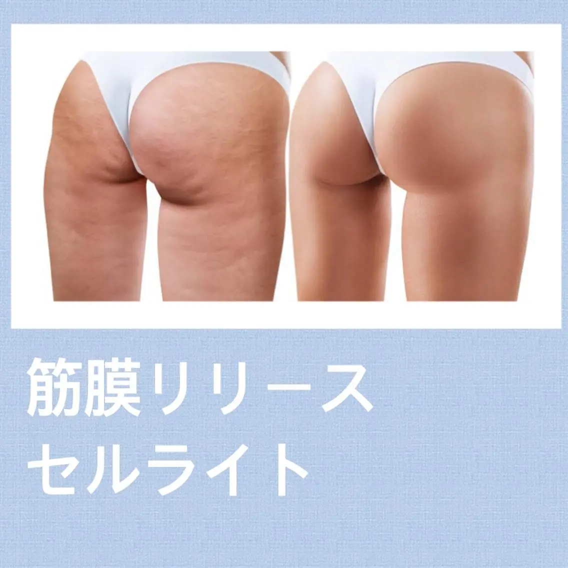 ボディ人気No.1🔥筋膜リリース&セルライトトリートメント 90分🔥の写真