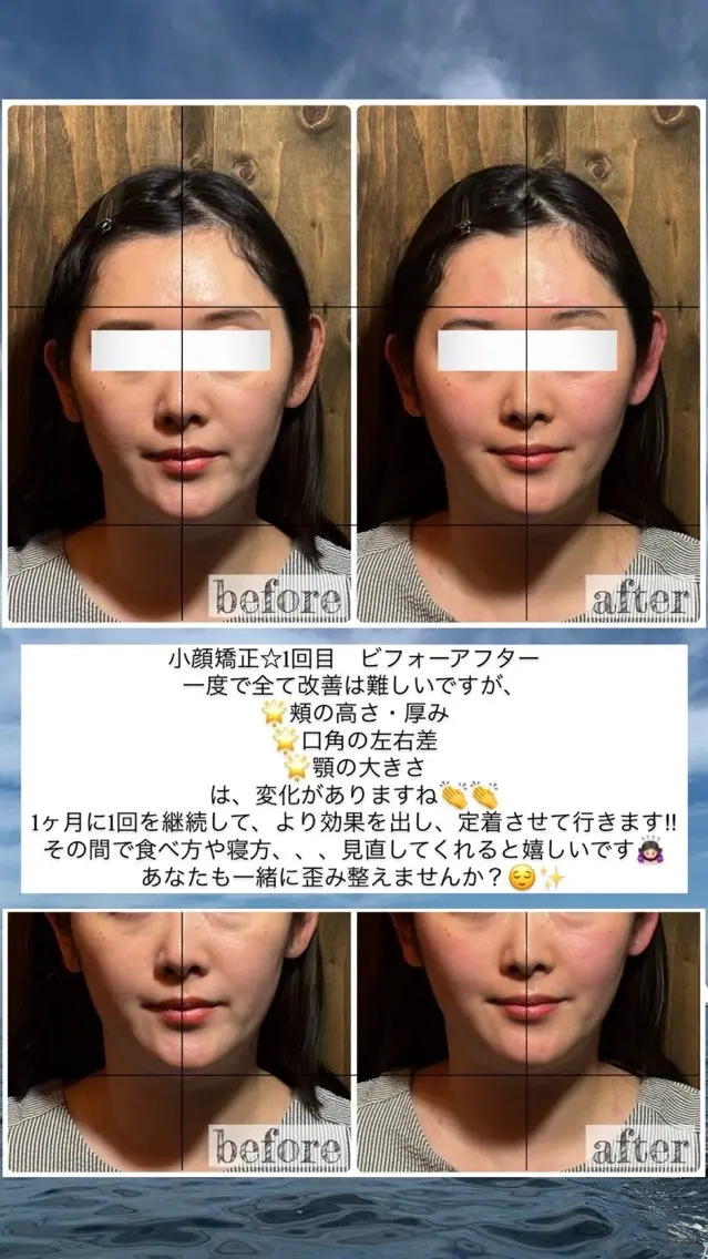 エステ リラク 💎後悔させない小顔 矯正💎イトヤマ🌱のエステ・リラクイメージ