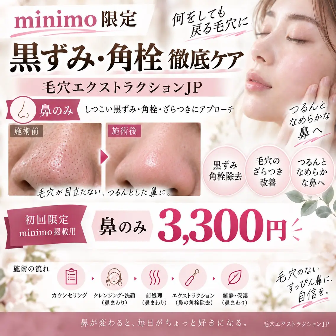 鼻のみ毛穴エクストラクションの写真