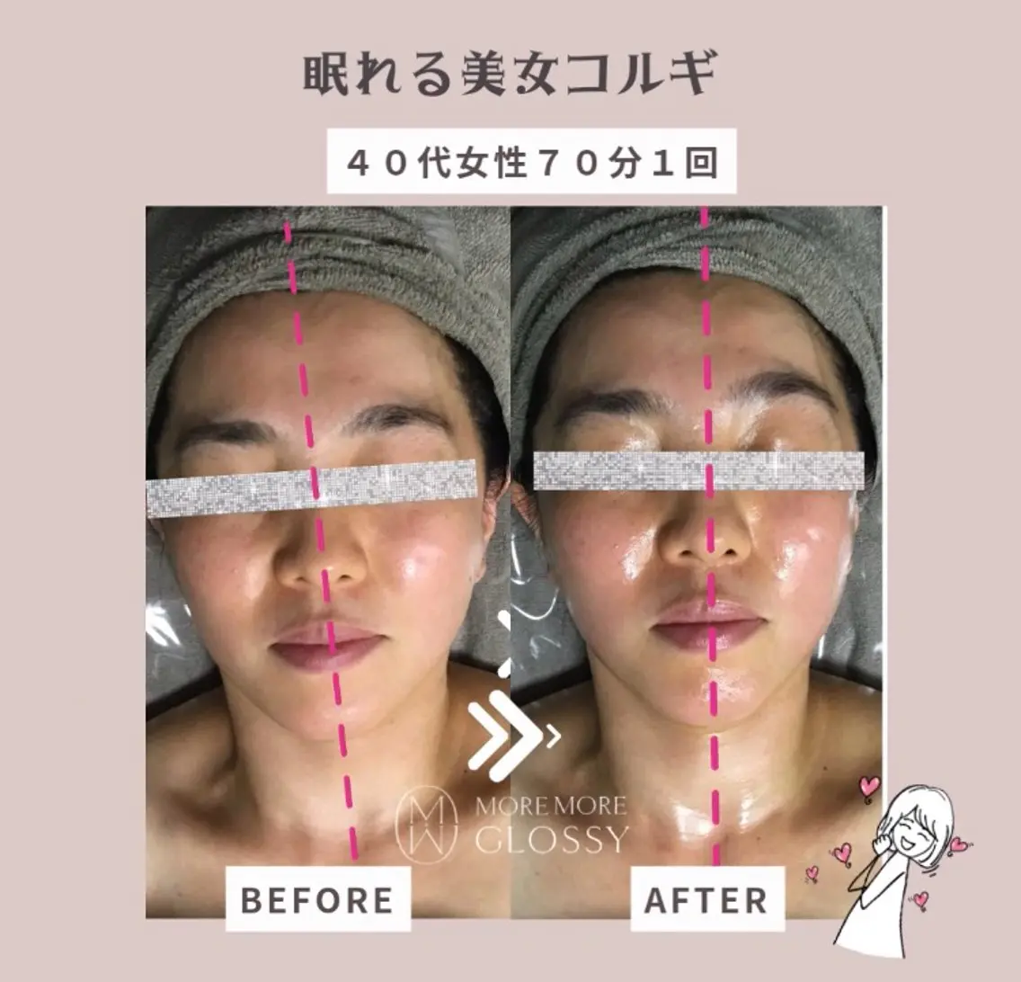 左右差、歪みが気になる方のお悩みに特化📣💎眠れる美女コルギ70分/お悩み別に特化した施術で理想のフェイスラインに💆の写真