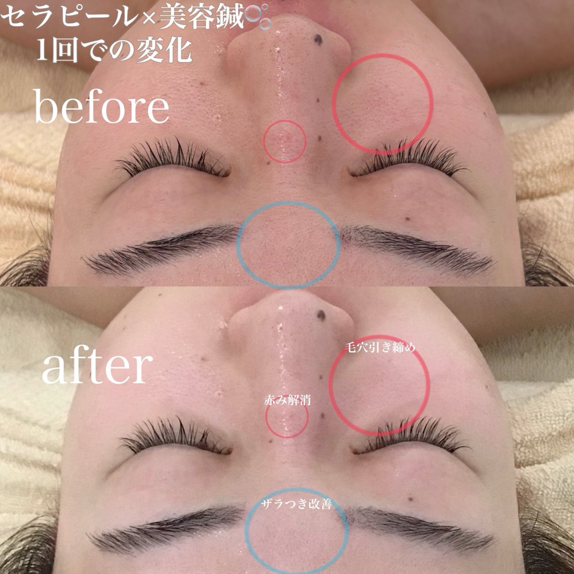 美容鍼灸院 acumond宮益坂のエステ・リラクイメージ