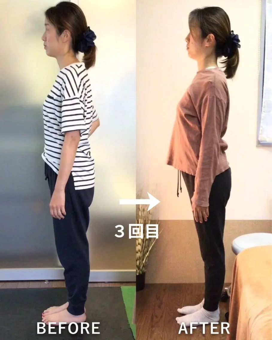 avantis鎌倉 💎小顔矯正　園田のエステ・リラクイメージ