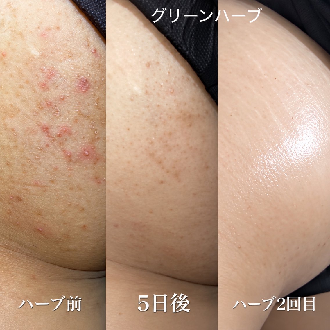 美肌革命×本格痩身店 癒し隠れ家salonのエステ・リラクイメージ