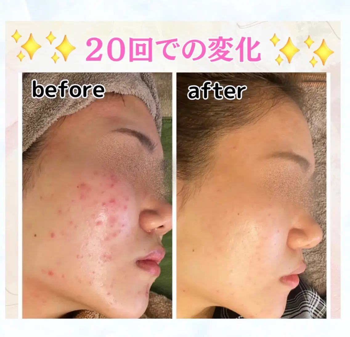 【2回目以降のご来店価格】の写真