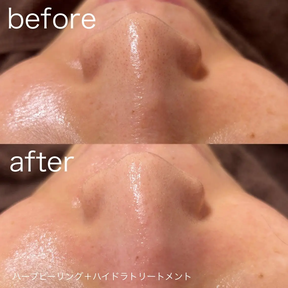 脱毛 lulularico Yuのネイルデザイン