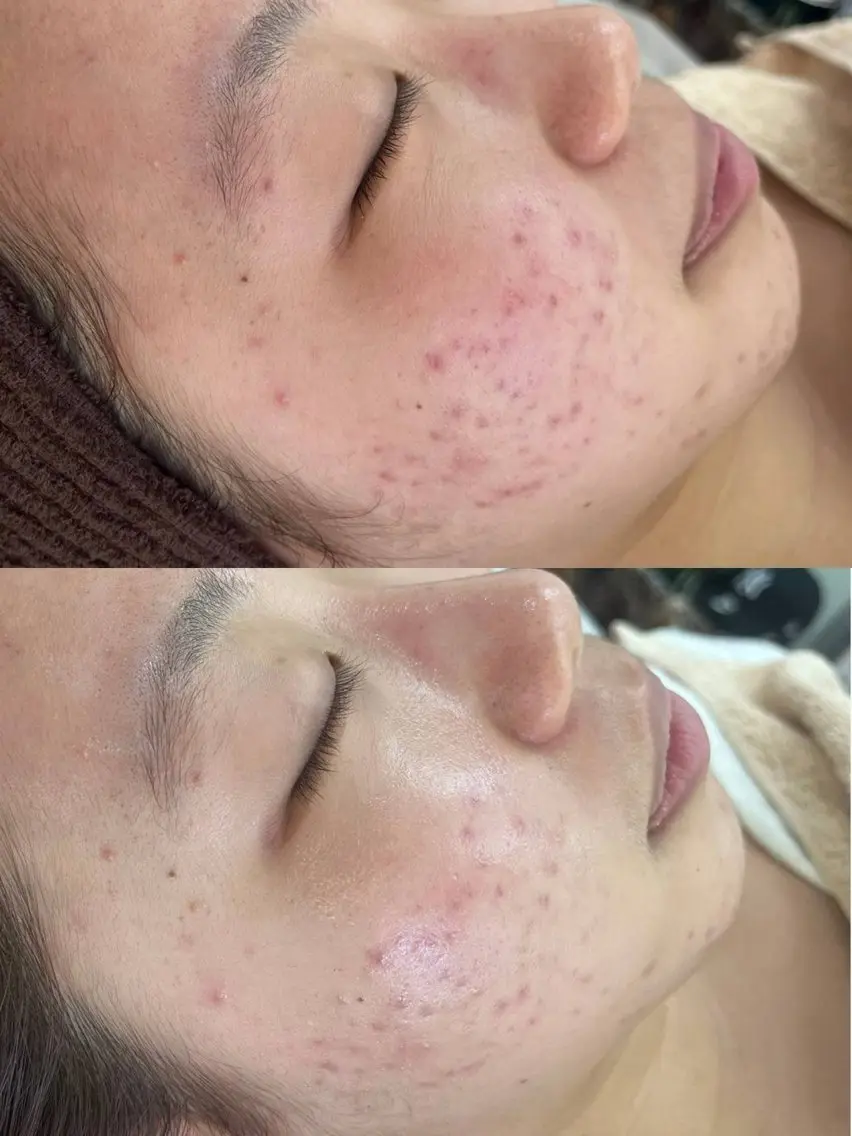 BeautySalo nCielChibaのエステ・リラクイメージ