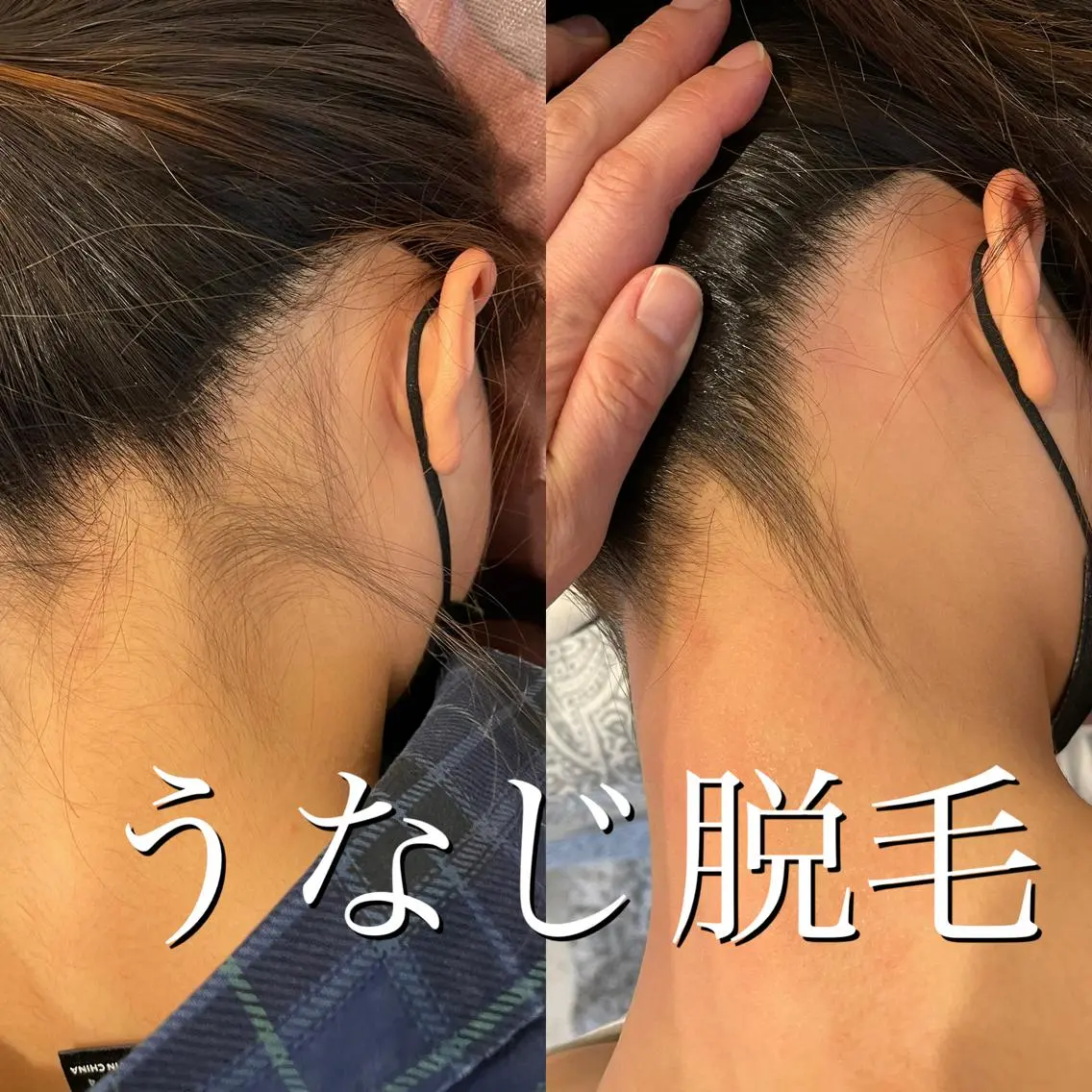 ショート ヘアアレンジ 脱毛 女性のお悩み美容 サロン　ヴィーナスのエステ・リラクイメージ
