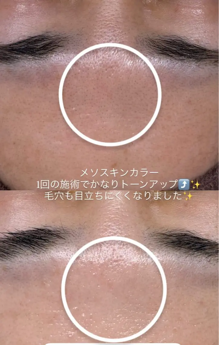 エステ リラク 肌質改善サロン réposのその他イメージ