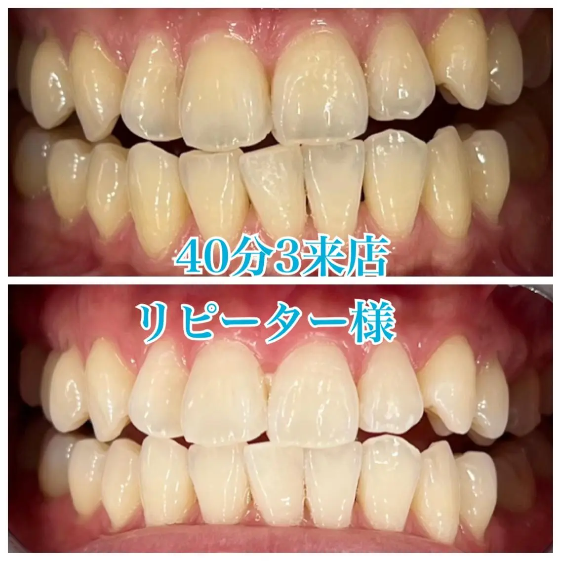 ホワイトニング🦷 ネイル💅LEAのその他イメージ