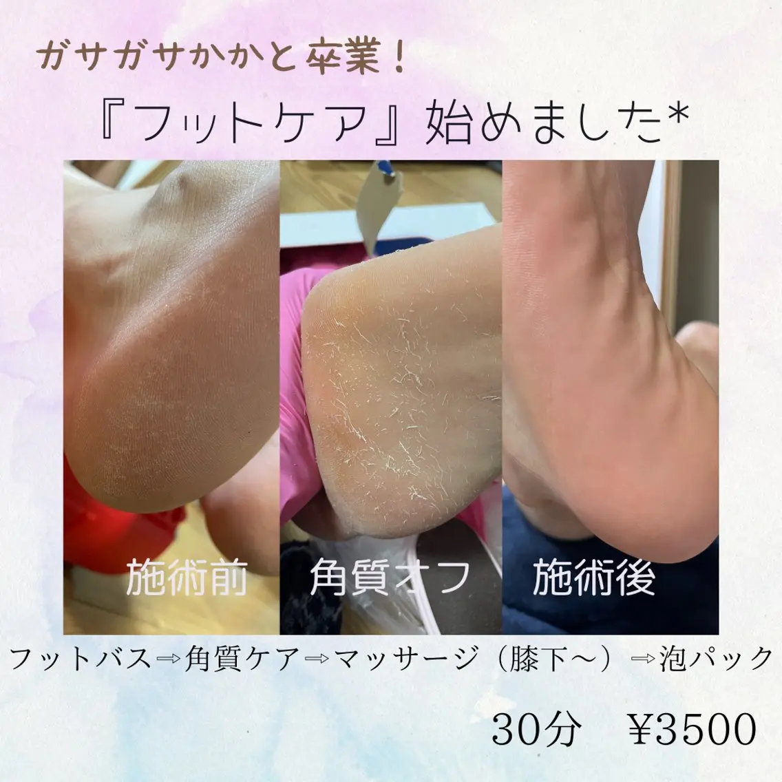 岸和田／久米田 MooMooのエステ・リラクイメージ