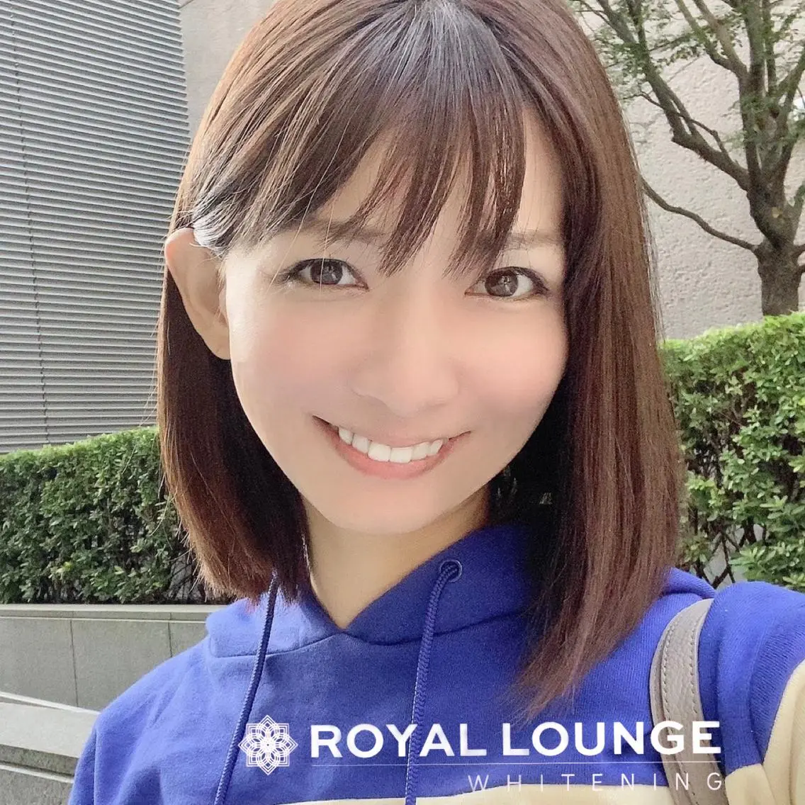 プレゼント付き🎁【ダブルプレミアムホワイトニング】🦷合計20回4来店　ジェル代別途の写真