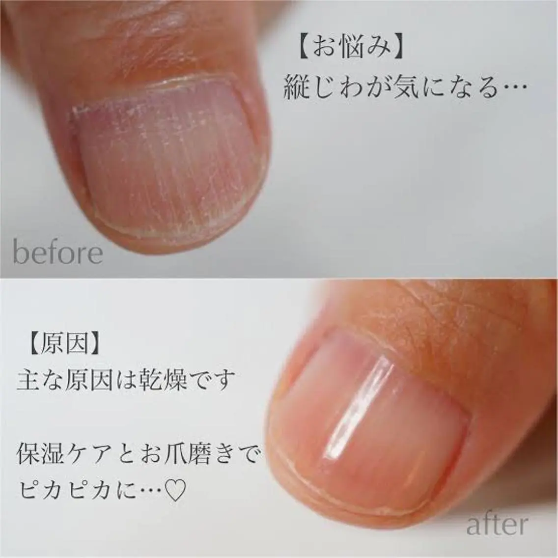 ハンドウォーターケア　就活や接待など手元をきれいに✨の写真