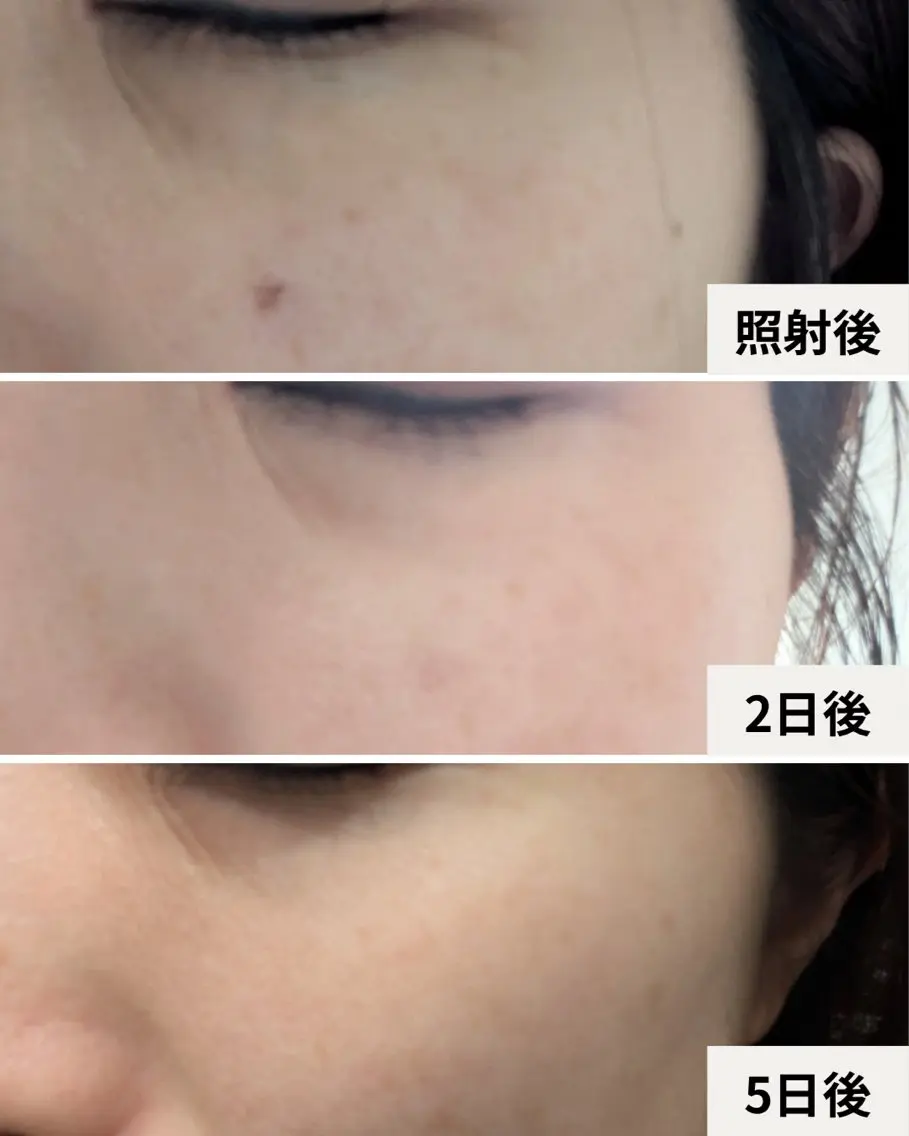 伊藤 実乃里のエステ・リラクイメージ