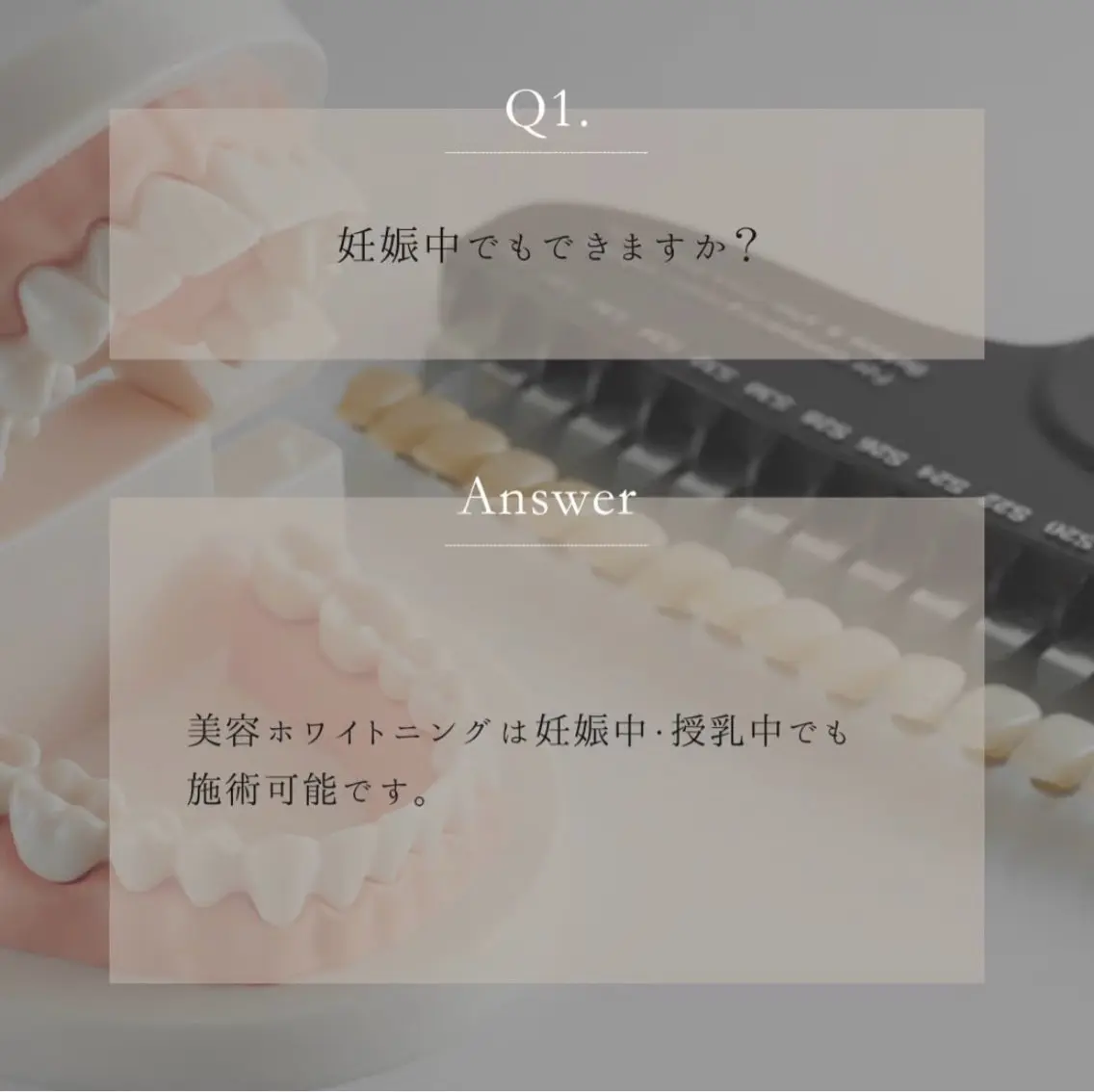 キッズ エステ ホワイトニングサロン Ecru エクリュのその他イメージ