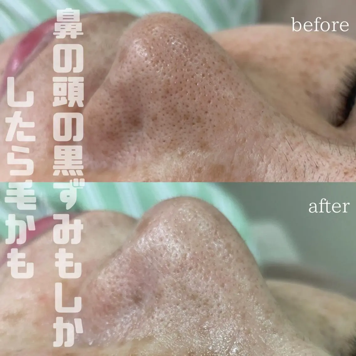 mish eyebrowのエステ・リラクイメージ