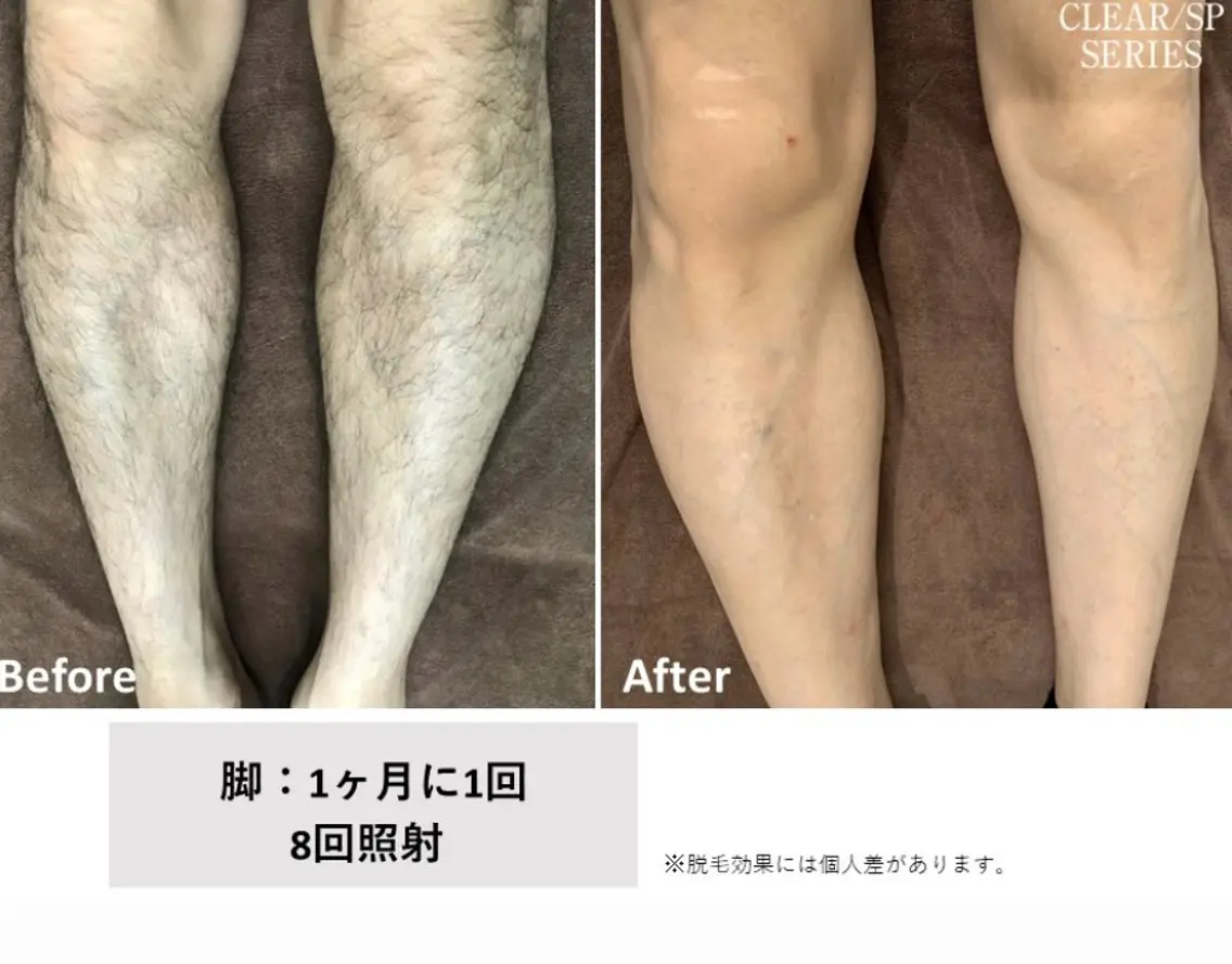 メンズ プライベートサロン Belleのエステ・リラクイメージ