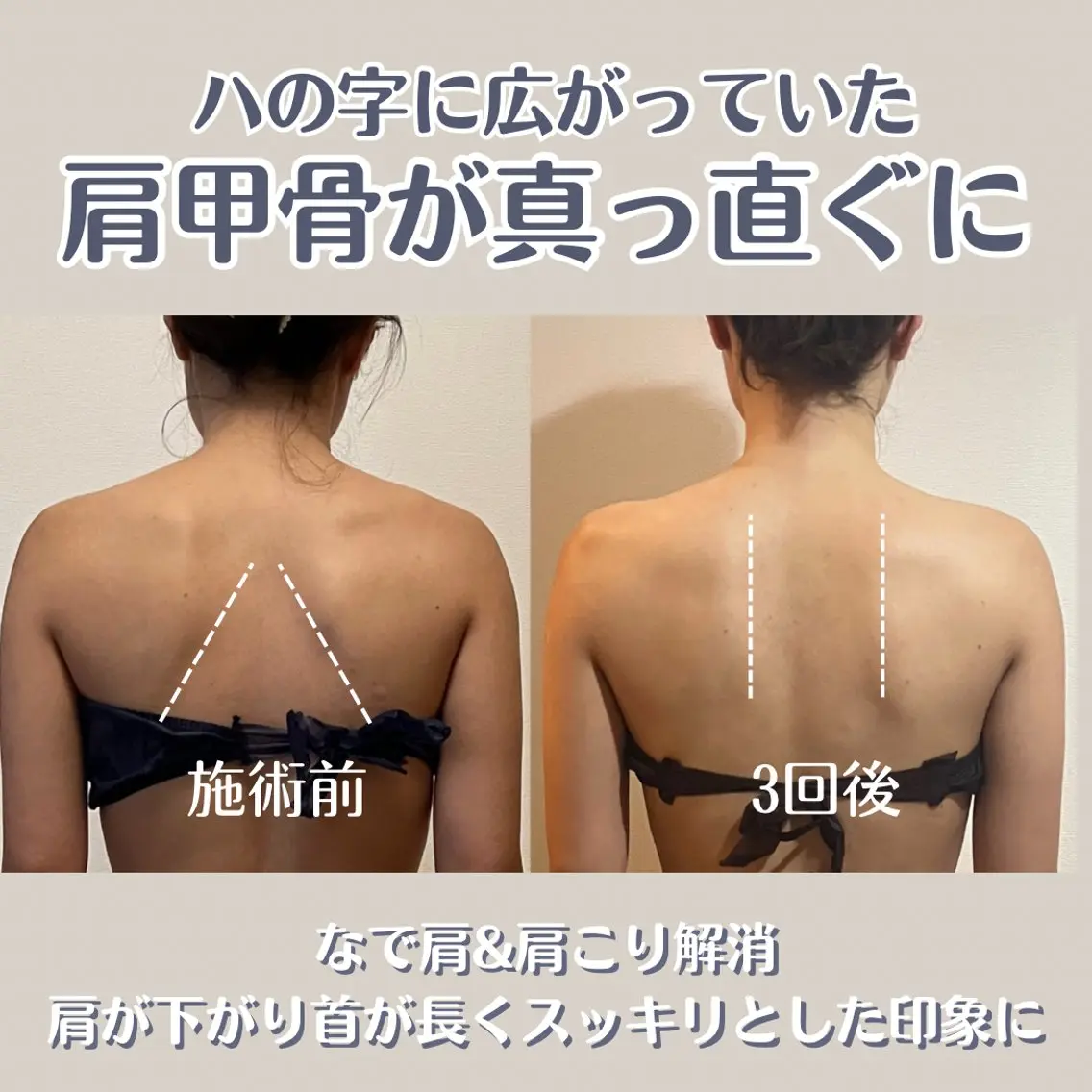 小顔矯正/骨格矯正 AKANEのエステ・リラクイメージ