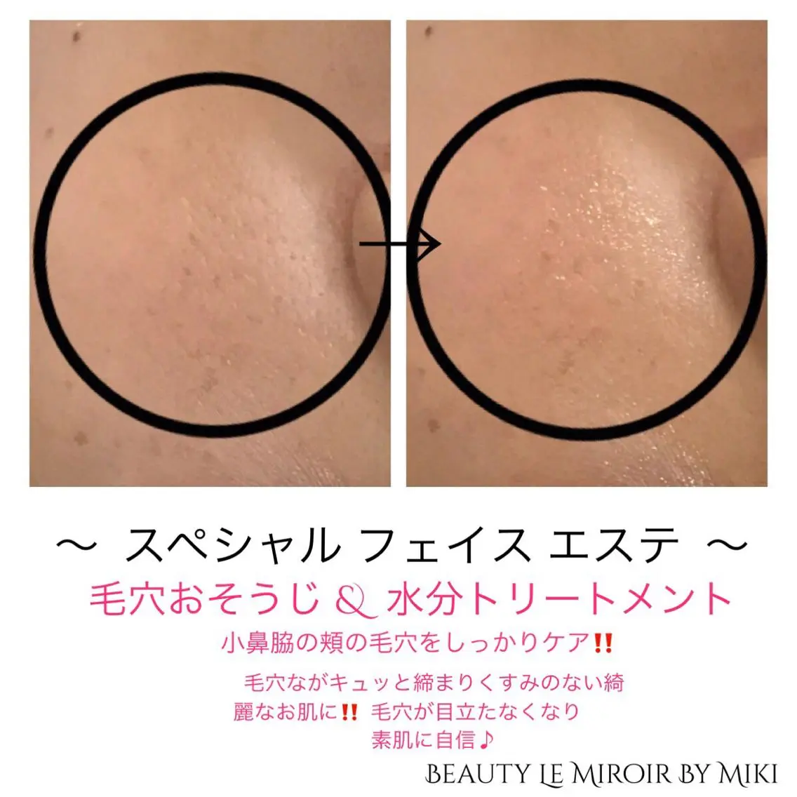 ビューティー ミロワールのエステ・リラクイメージ