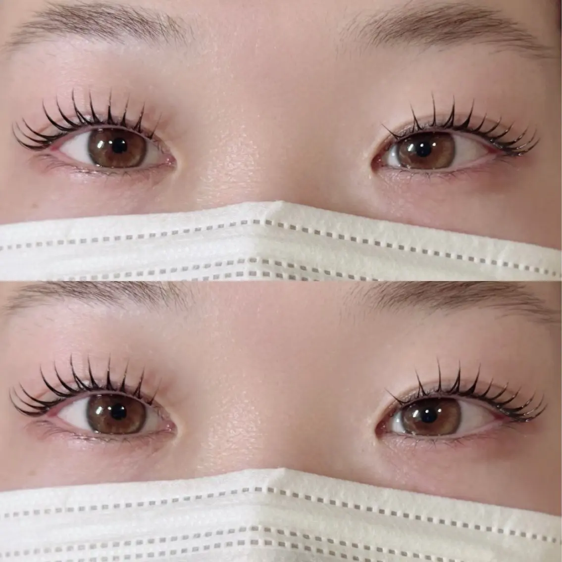 フラットプラス 50セット(100本)🧊✨️の写真