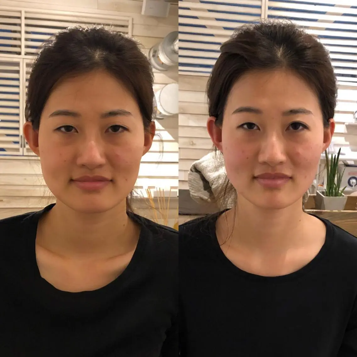 恵比寿/代官山 鍼灸師/根本亮佑のエステ・リラクイメージ