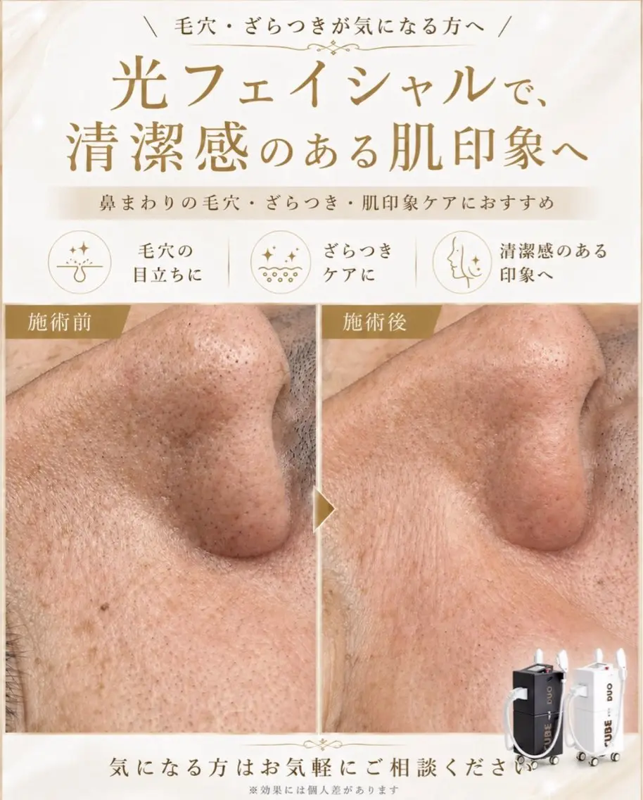 エステ 脱毛サロン ベル・マタンのエステ・リラクイメージ