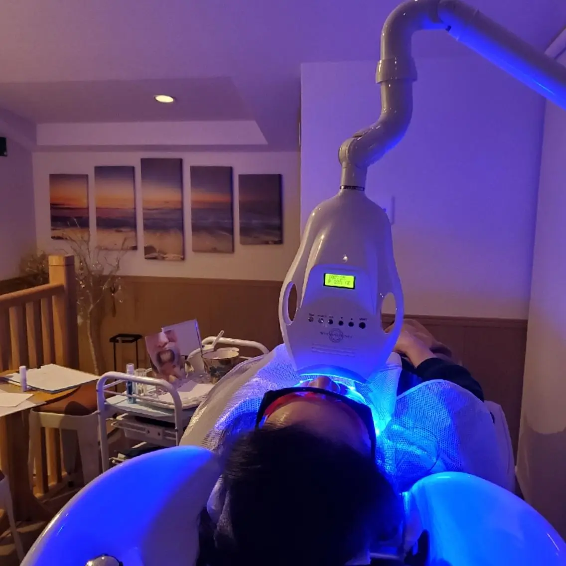 歯のホワイトニング(チケット無し再来の方用)の写真
