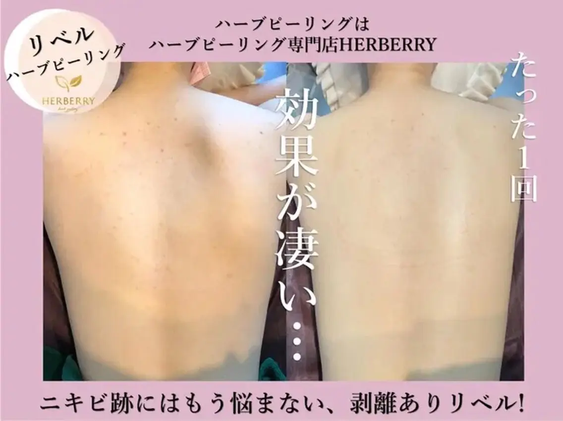 ハーブピーリング専門 HERBERRY冨永のエステ・リラクイメージ