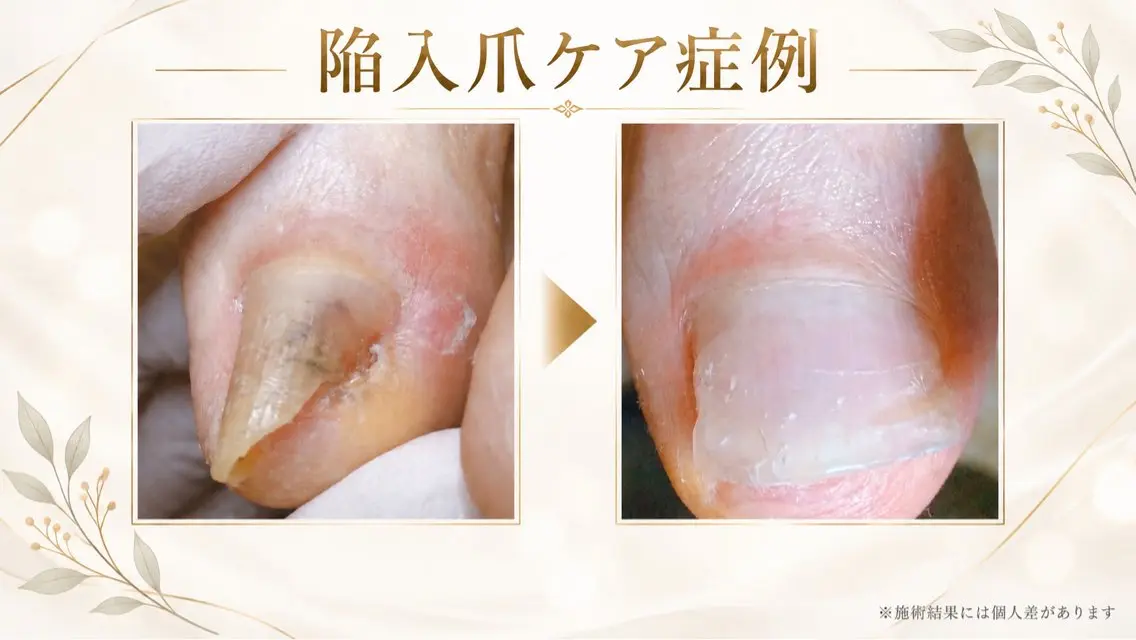 ネイル ドクターネイル爪革命 takahashiのその他イメージ