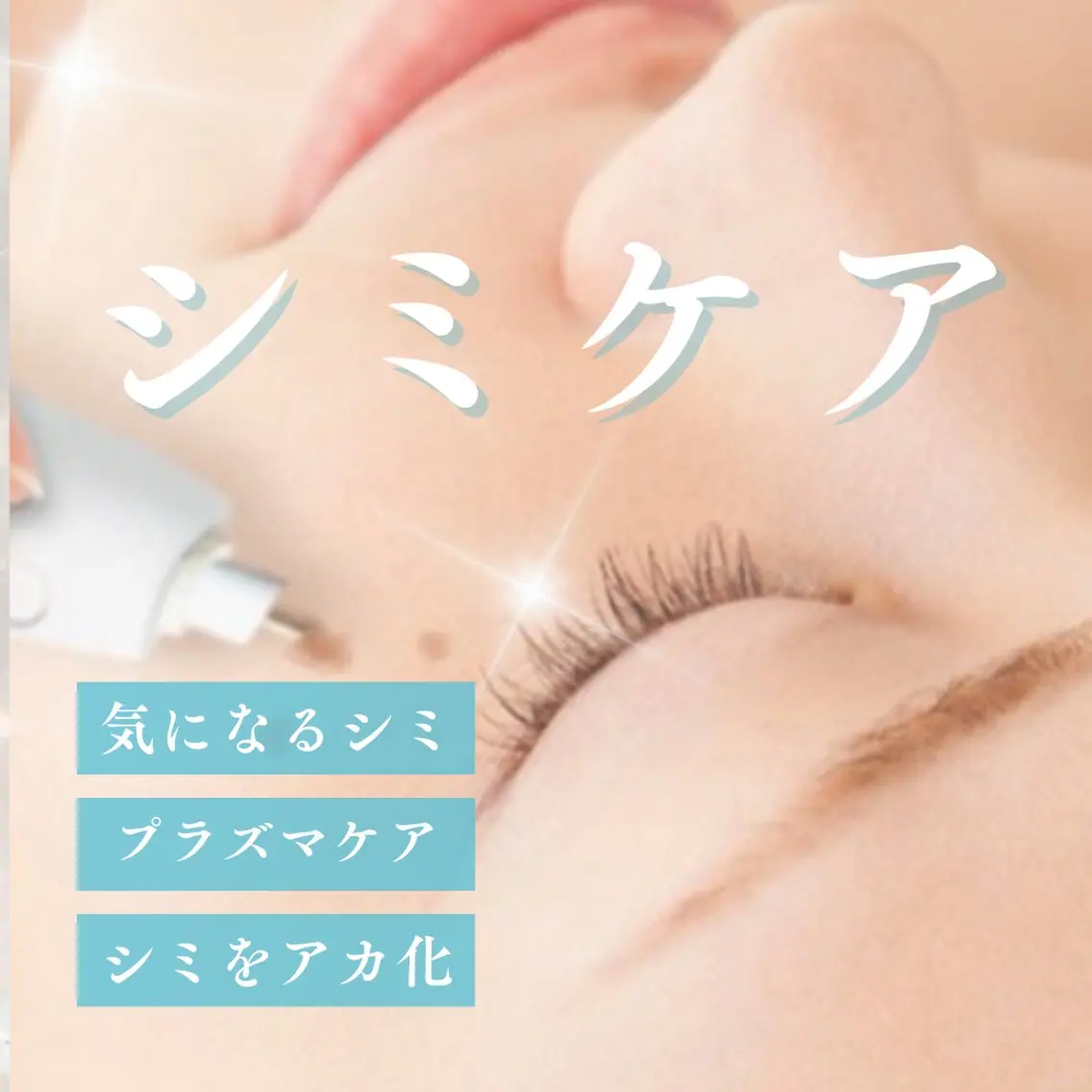 ✨シミケア特化✨プラズマシャワー&プラズマ導入+プラズマシミ集中ケア(全顔)(60分)の写真