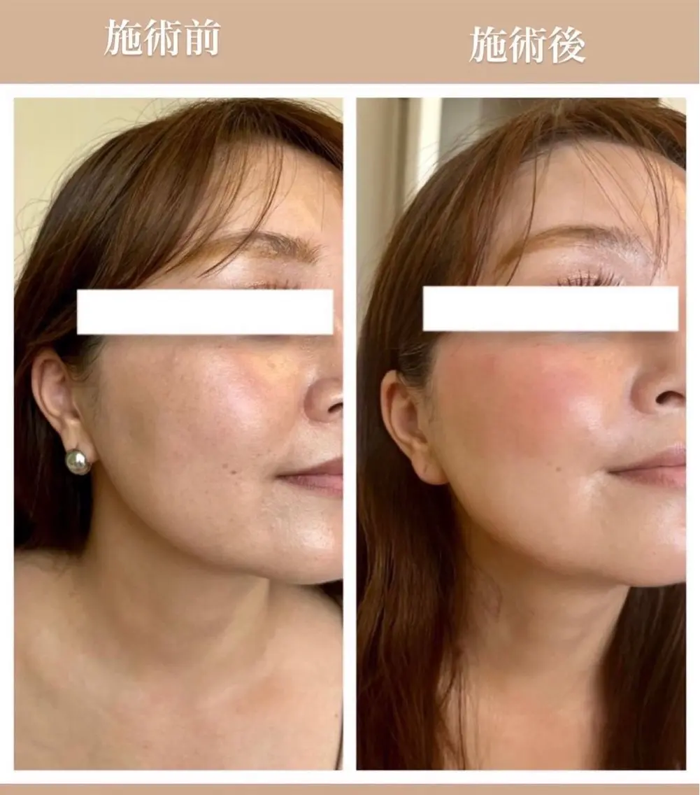 エステ FUWARY beauty&spaのエステ・リラクイメージ