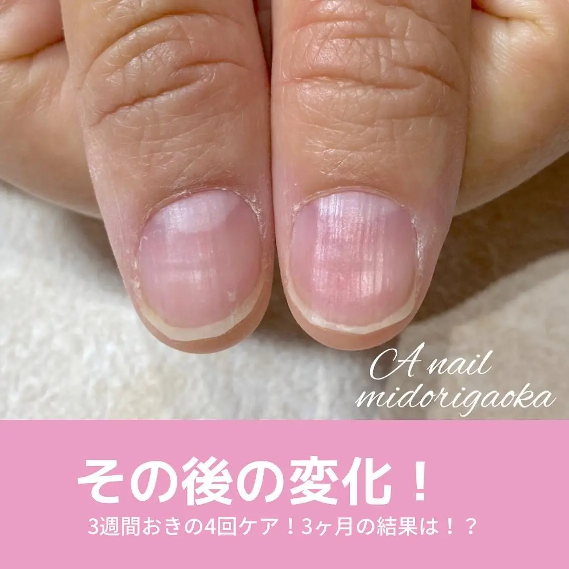 ネイル ハンドネイル ハンドケア 大人可愛い高技術ネイ ル♡美爪A nailのネイルデザイン