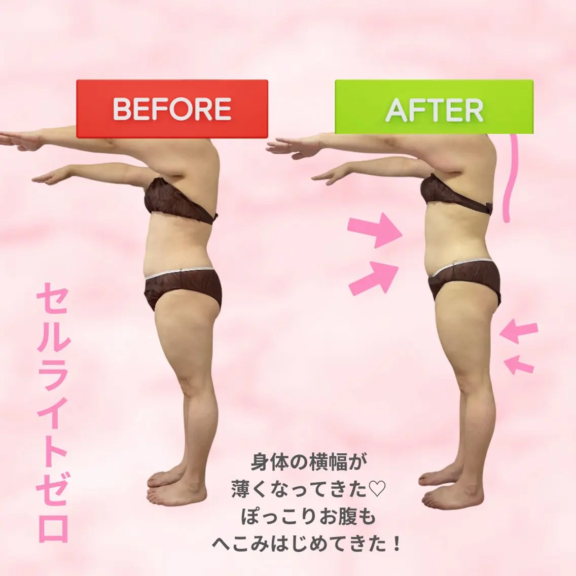 エステ 肌質改善サロン ココマヒナのエステ・リラクイメージ