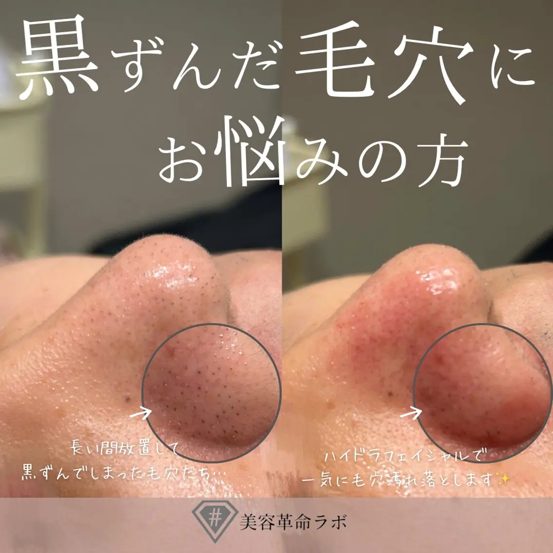 💎美容革命ラボ💎 大名店のエステ・リラクイメージ