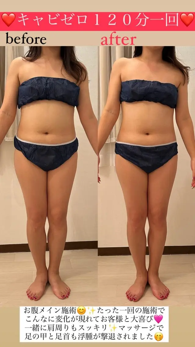 ⭐️速攻痩せダイエット痩身❤️‍🔥キャビゼロ120分の写真
