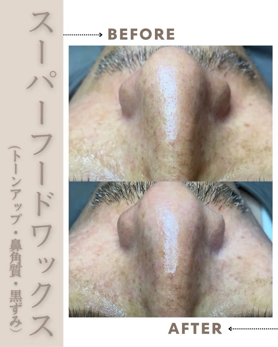 SPIRE 〜スパイア〜のエステ・リラクイメージ