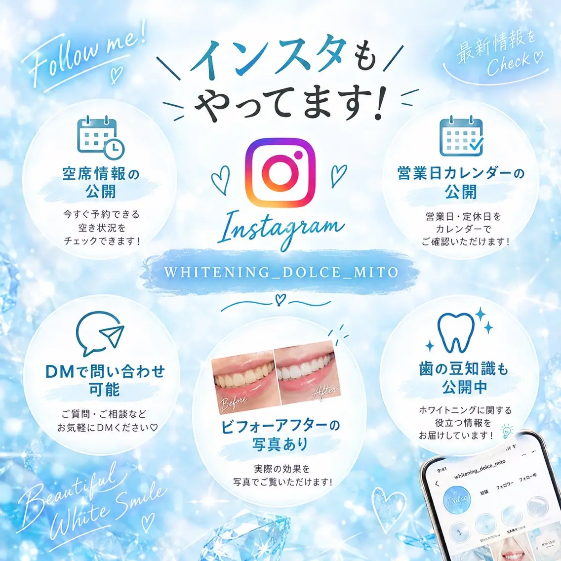 メンズ その他 セルフホワイトニング Dolce水戸店のその他イメージ