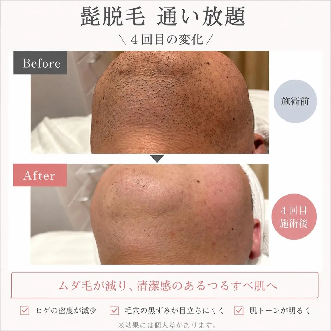 【メンズ脱毛・美肌】 SARA 恵比寿店のエステ・リラクイメージ