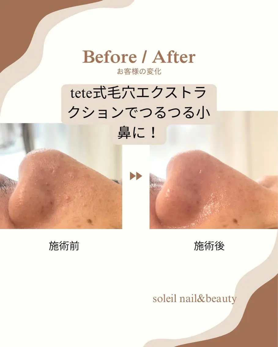 つるん鼻コースの写真