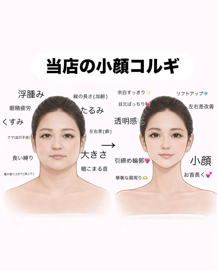 【リフト小顔】オーダーメイド小顔コルギ60分の写真