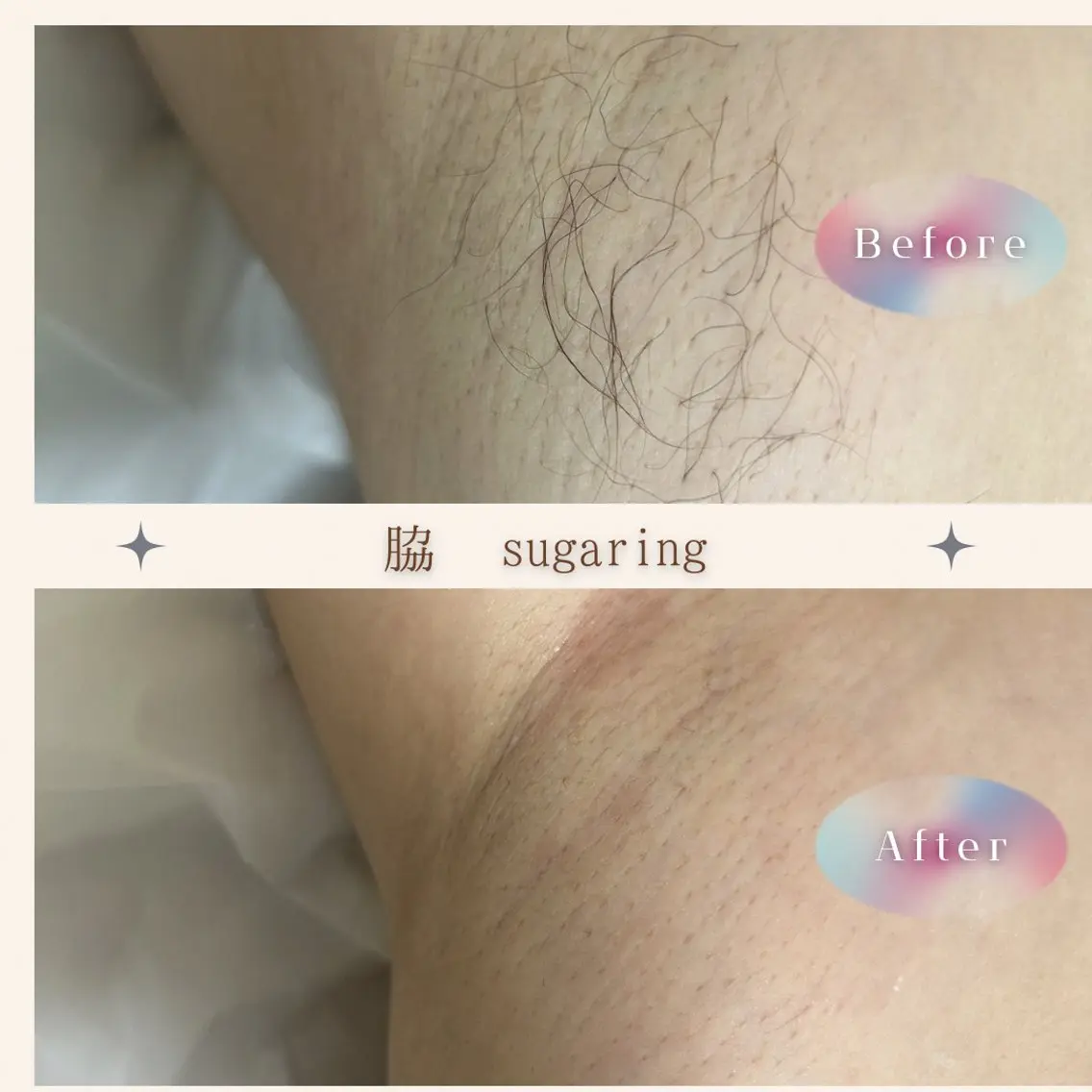 sugaring miiiのエステ・リラクイメージ
