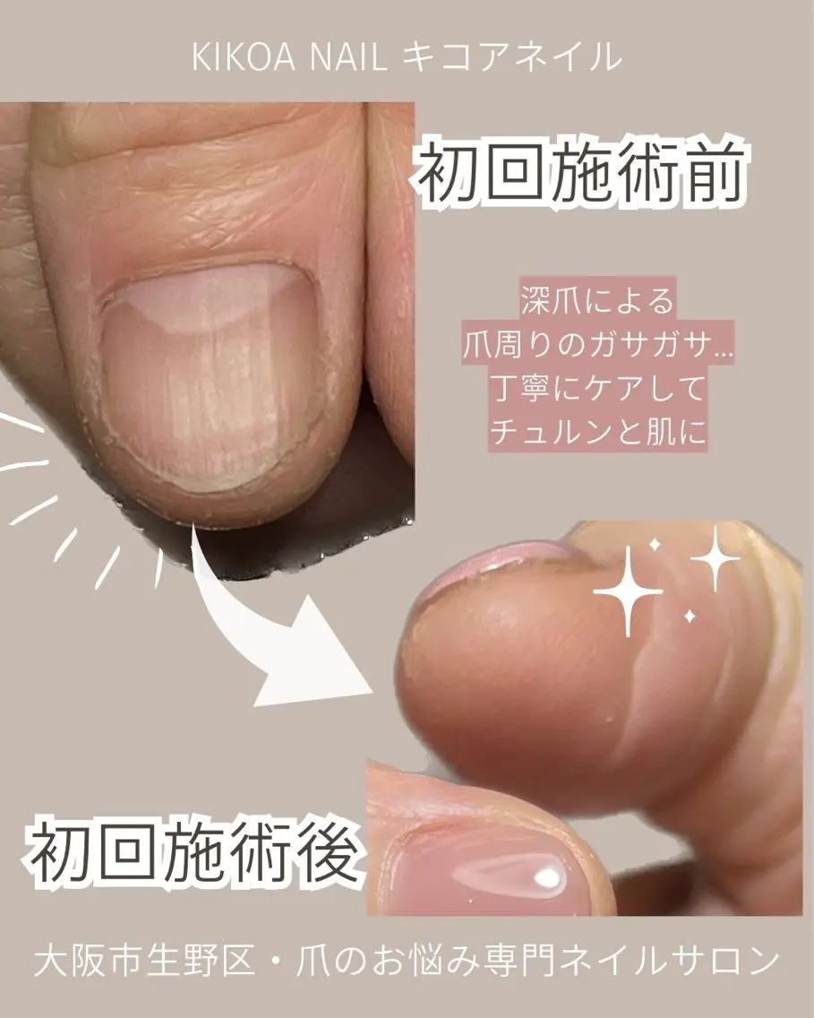 ネイル KIKOA NAIL キコアネイルのネイルデザイン