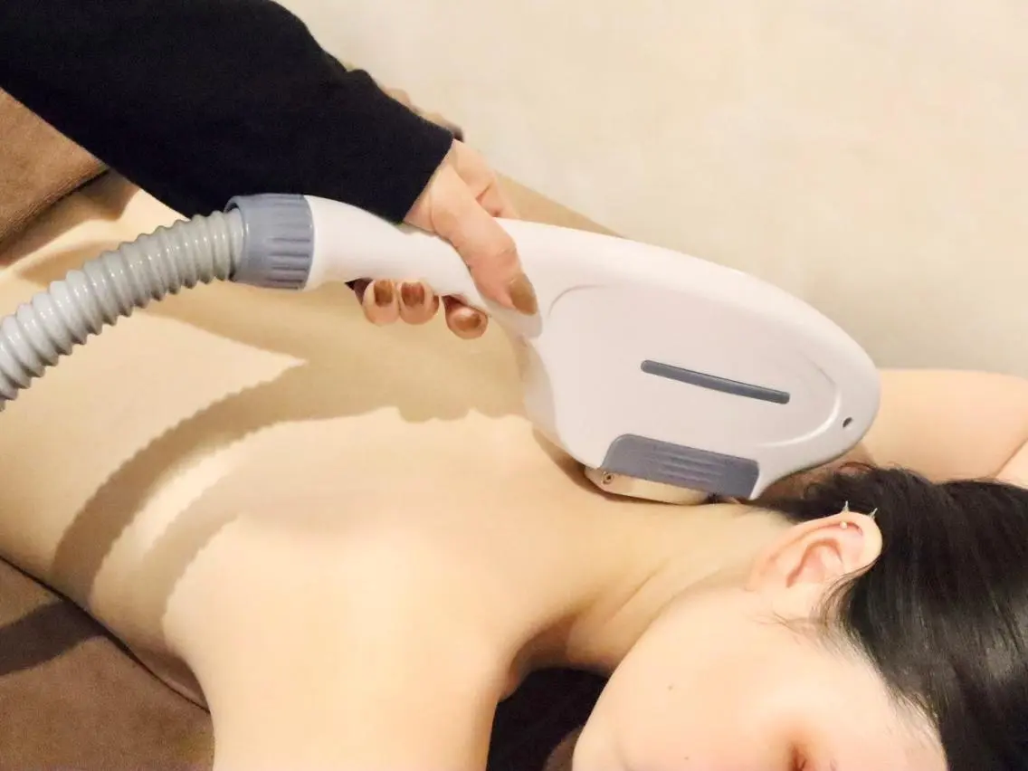 <エステ業界最大出力3000Wの最新脱毛器使用>顔、両脇、背中から1つ選択可能!の写真
