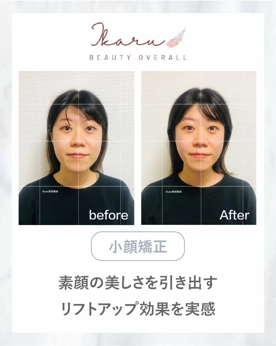 ikaru美容整体 猪田のエステ・リラクイメージ