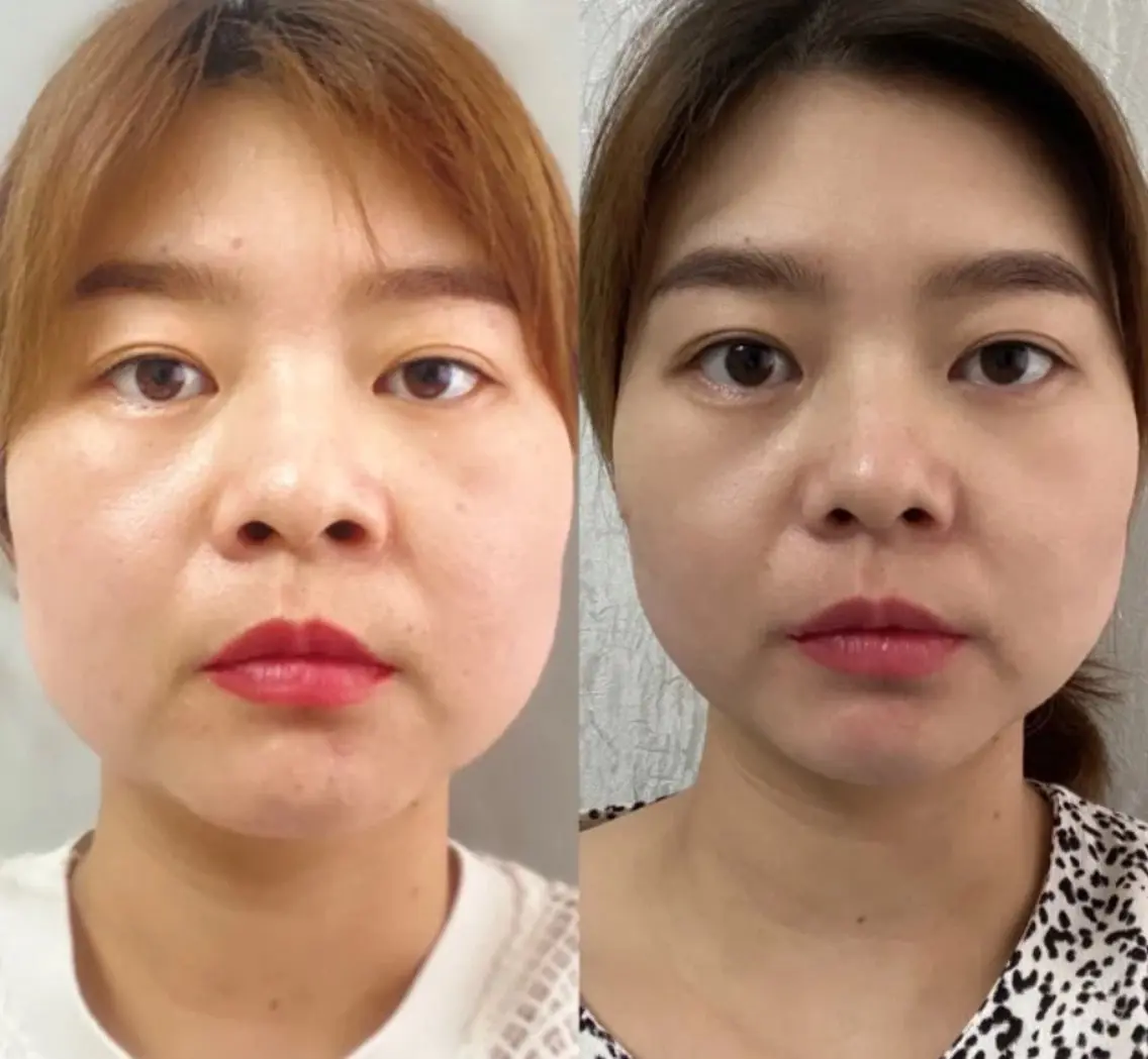 【再来｜オンダリフト】リピーター様専用✨の写真