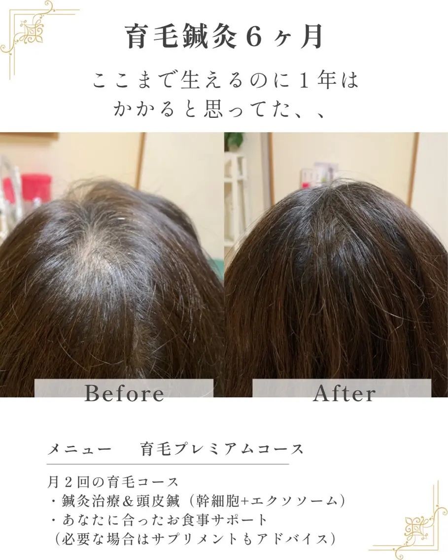 美容鍼灸師 齋藤 麗子のその他イメージ