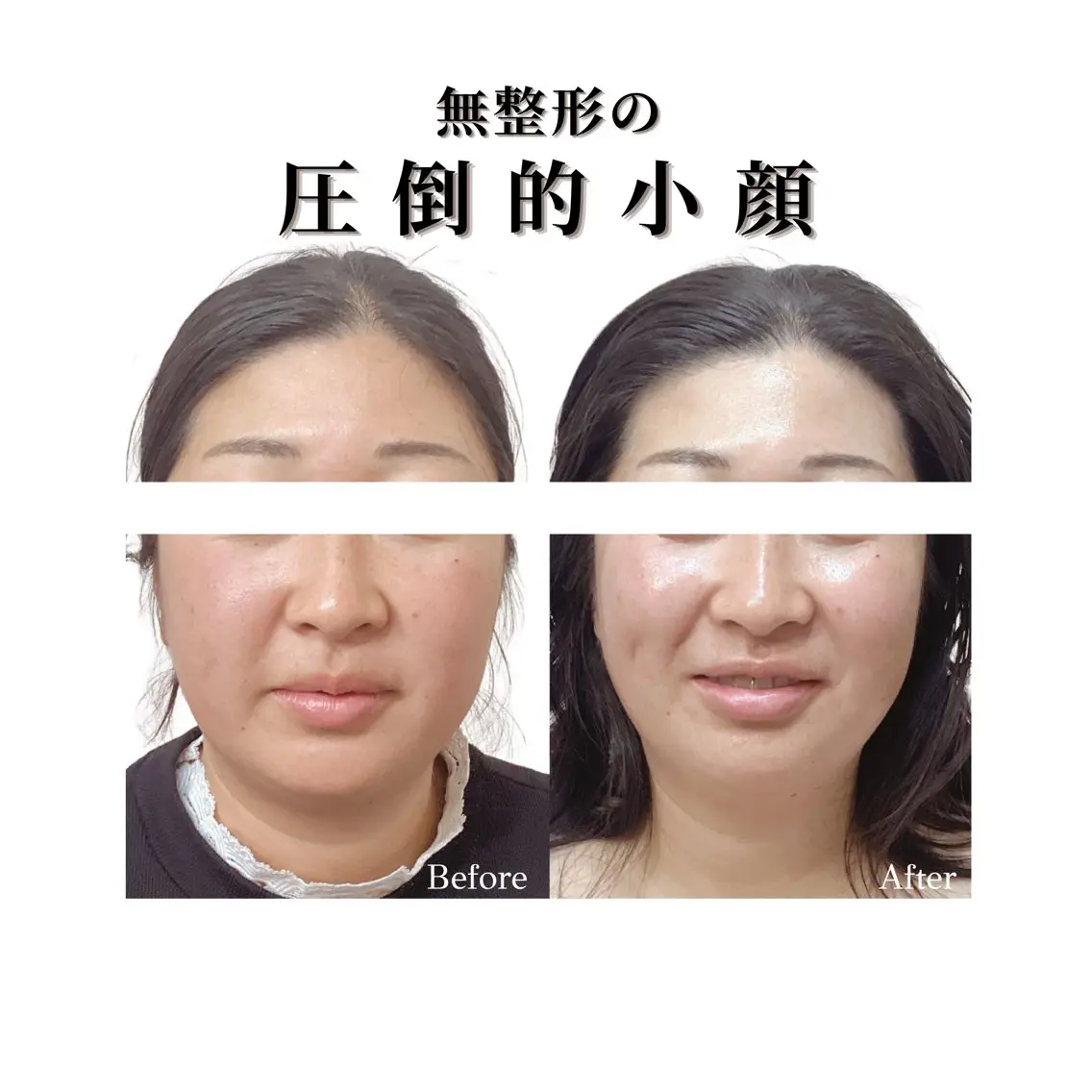 看護師 AYUIのエステ・リラクイメージ