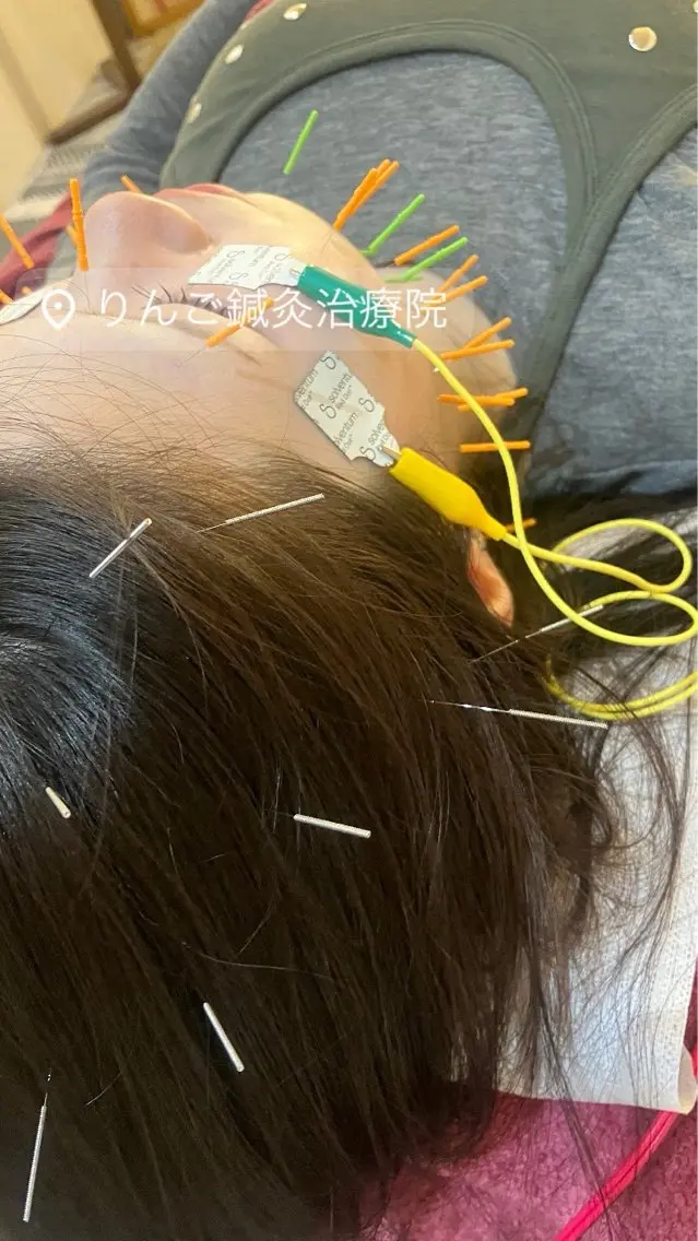 エステ リラク 美容鍼灸女性専用 りんご鍼灸治療院のその他イメージ