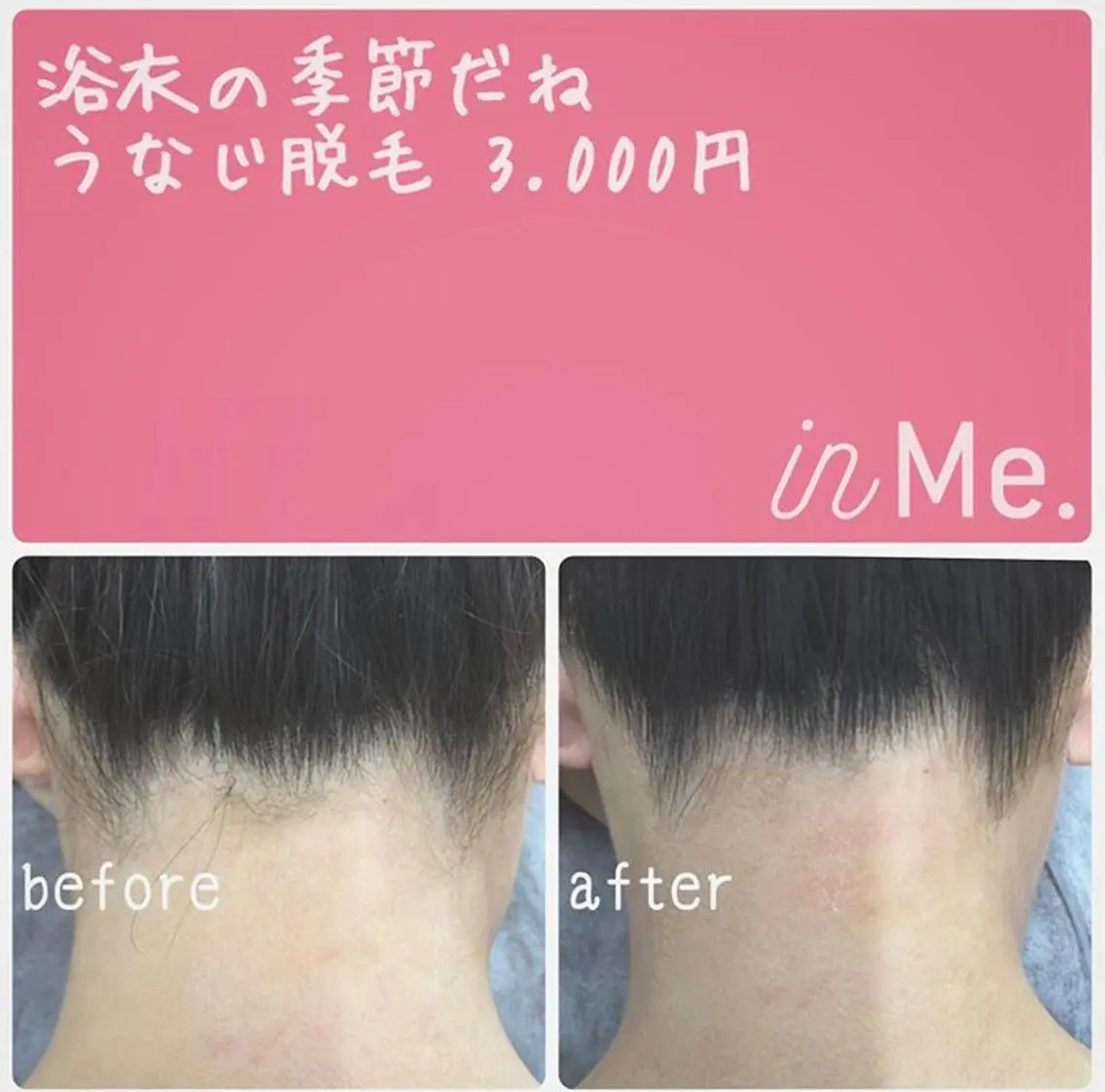 ◆つど払い脱毛◆ in Me.インミーのエステ・リラクイメージ