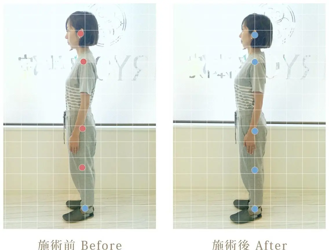 整体コース(首、肩、腰がつらい方、姿勢が悪くカラダの歪みが気になる方、朝起きても疲れがとれていない方にオススメ)の写真